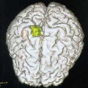 Immagini mediche